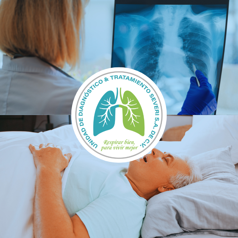 Imagen del artículo