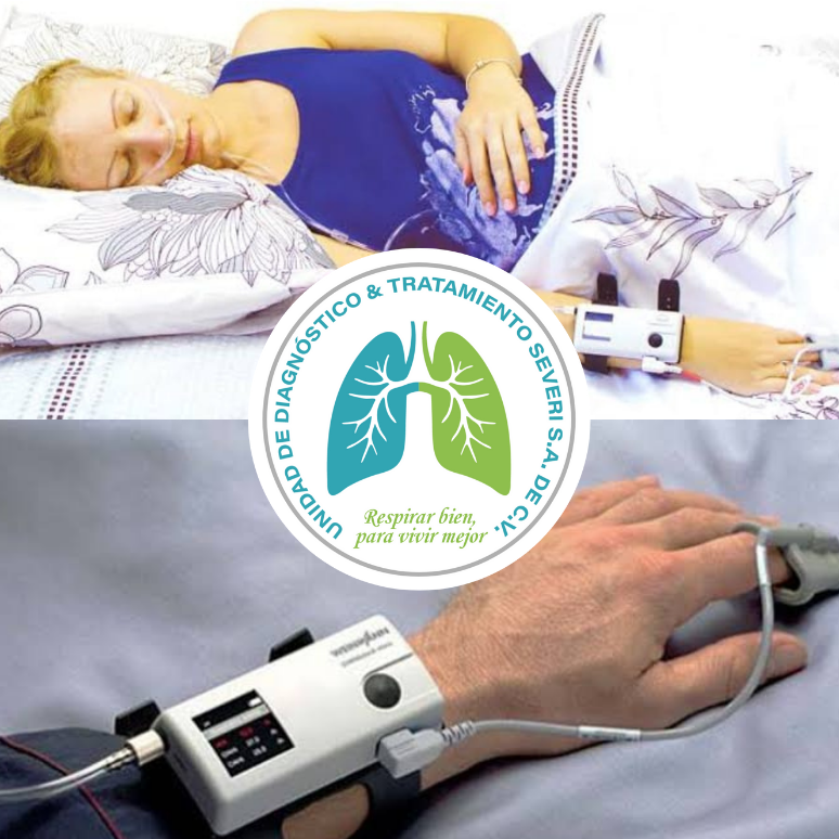 Imagen del artículo