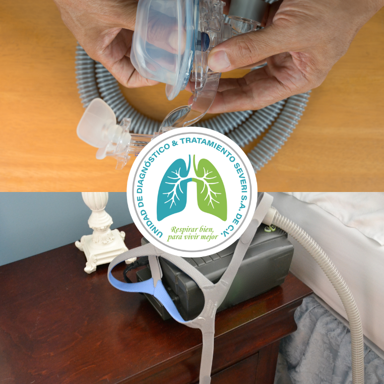 Imagen del artículo